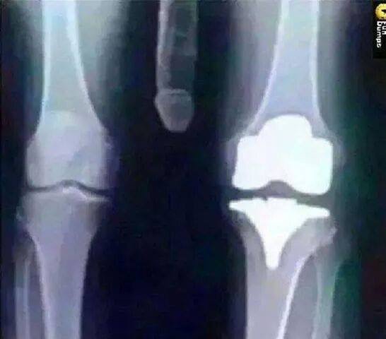 Name:  ImageUploadedByTapatalk1428425768.698672.jpg
Views: 568
Size:  40.0 KB