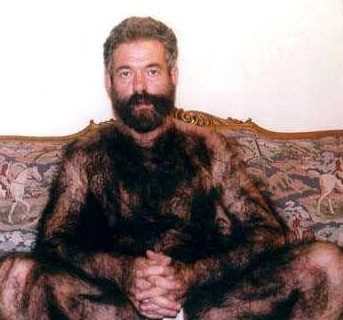 Name:  very-Hairy-Guy.jpg
Views: 3077
Size:  30.5 KB