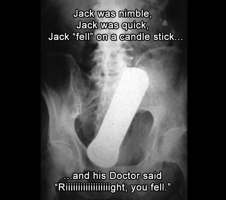 Name:  CANDLESTICK.jpg
Views: 1848
Size:  64.9 KB